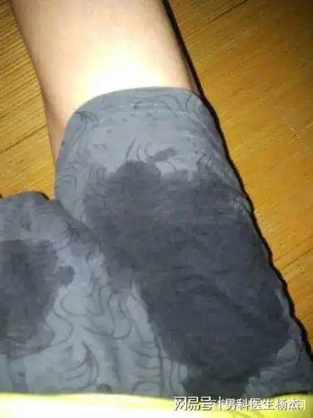 男孩子遗精需要治疗吗?